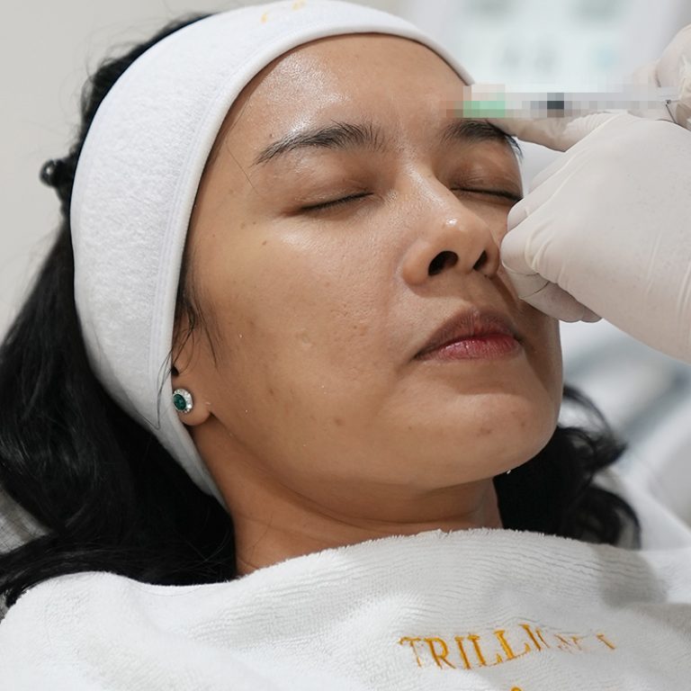 botox service trillion j clinic
